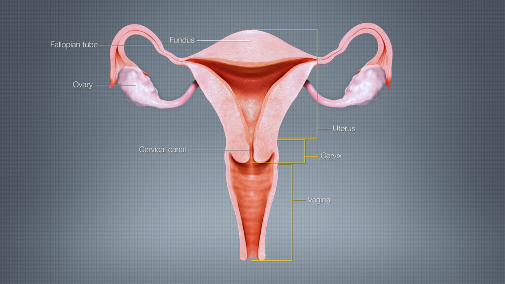 Uterus - Hysterectomy